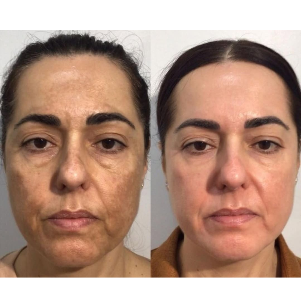 Untitled design - 2025-07-30T002036.826